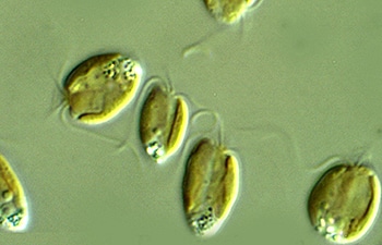 Prymnesium Parvum