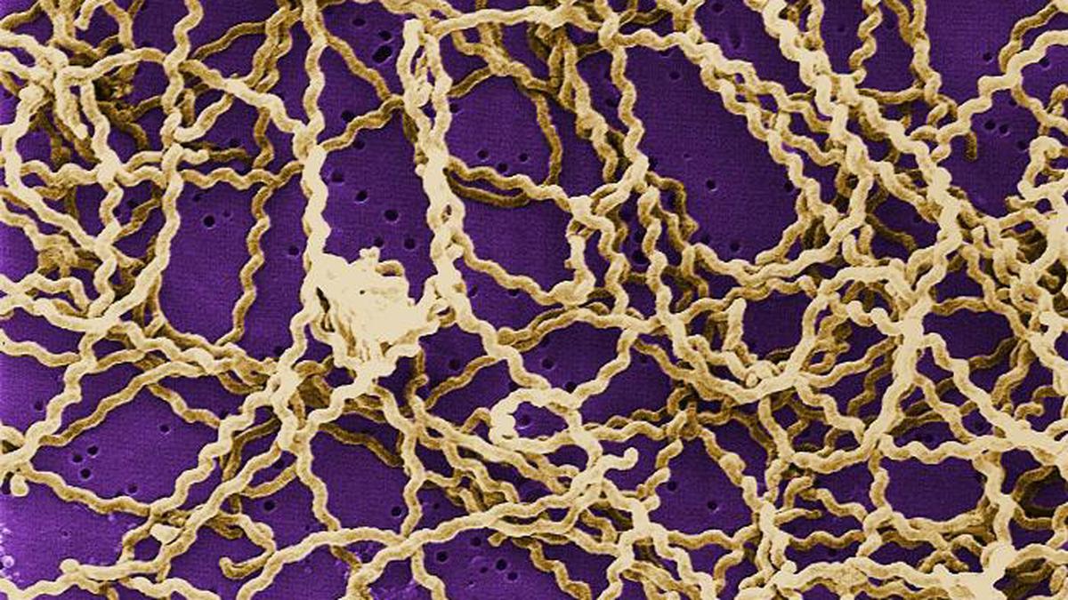 What is Leptospirosis?