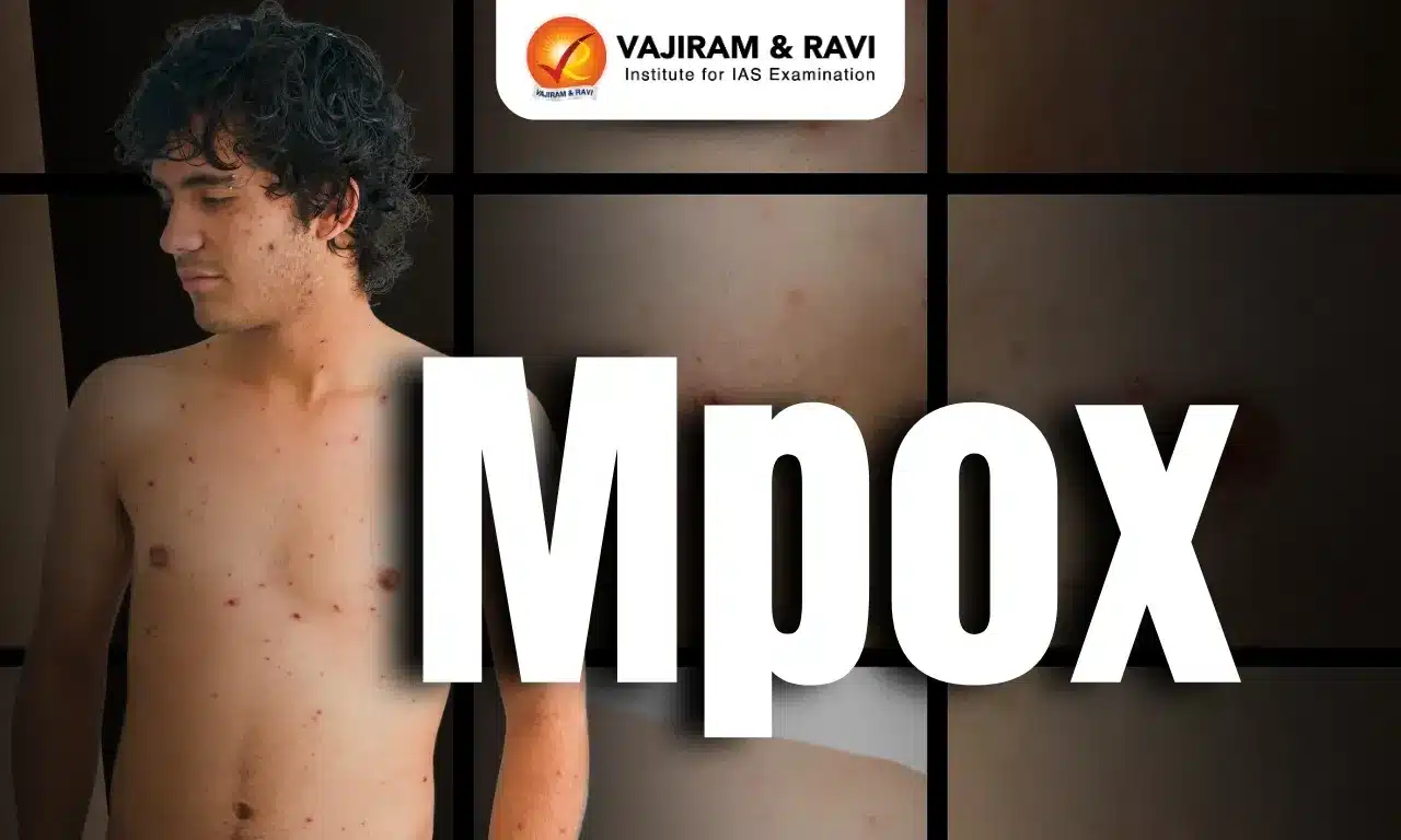 Monkeypox