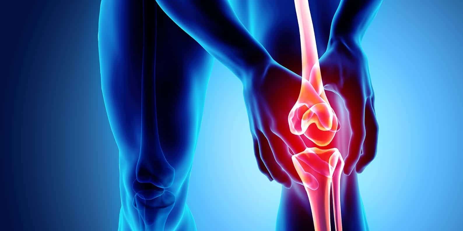 Arthritis