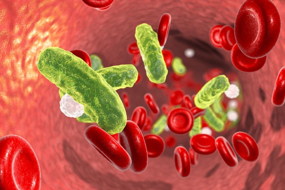 What is Sepsis?