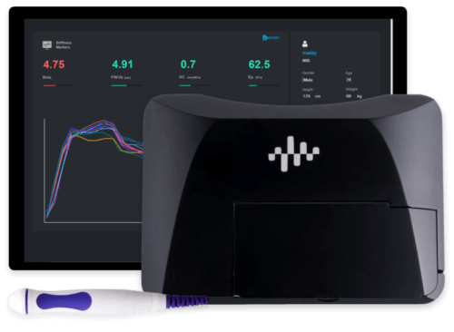 What is the ‘ARTSENS’ Device?