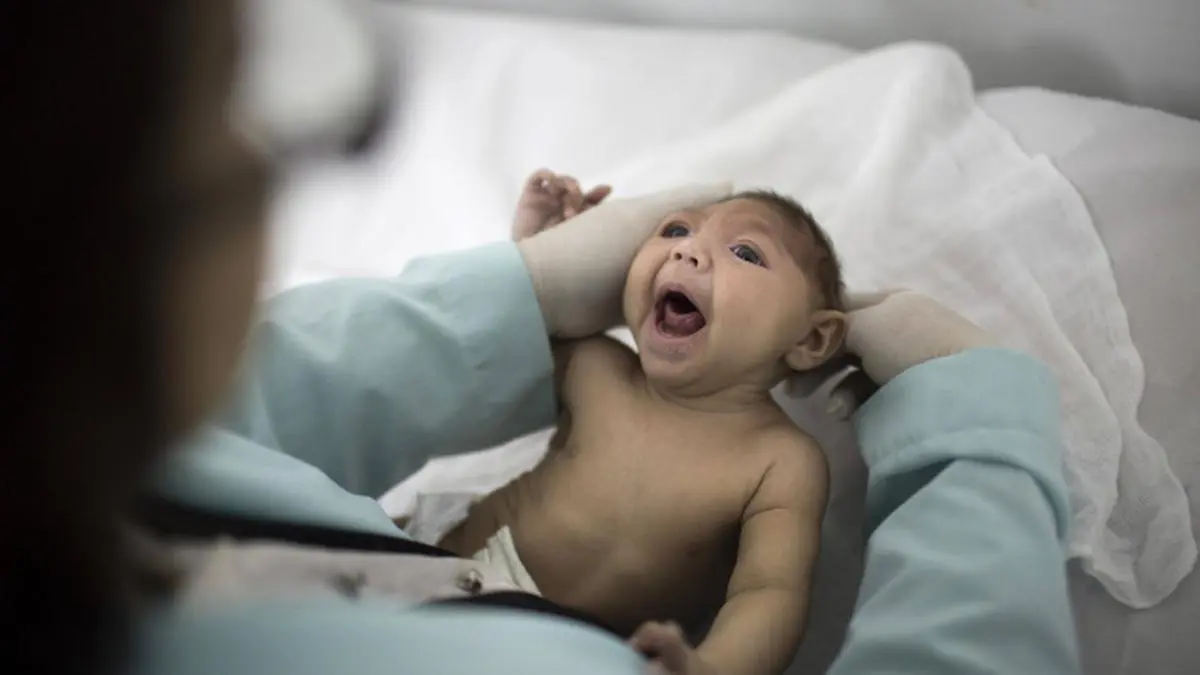 Microcephaly