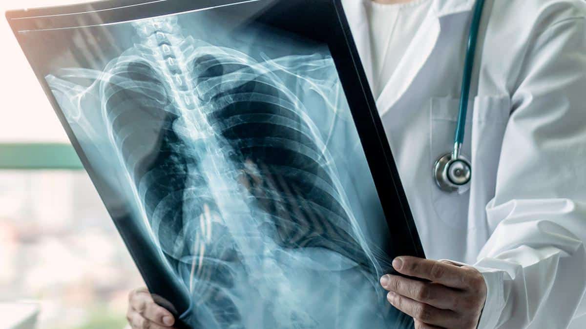 Cancer Screening in India