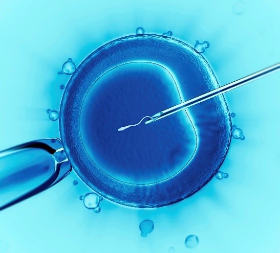 In Vitro Fertilization (IVF)