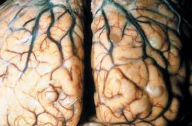 Neurocysticercosis