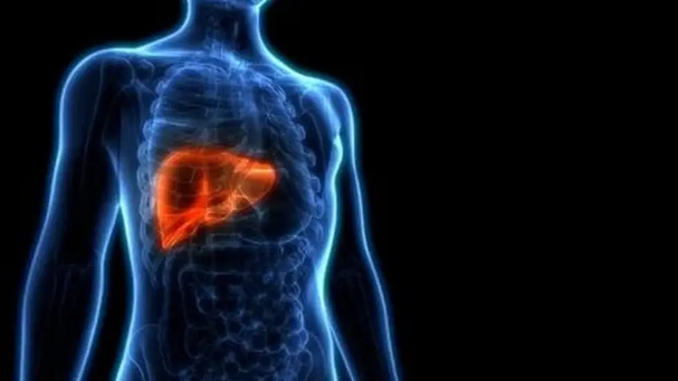 Nonalcoholic Steatohepatitis (NASH)