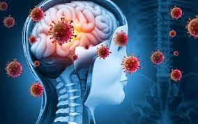 Rasmussen’s encephalitis