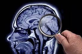 The New Alzheimer’s Drug