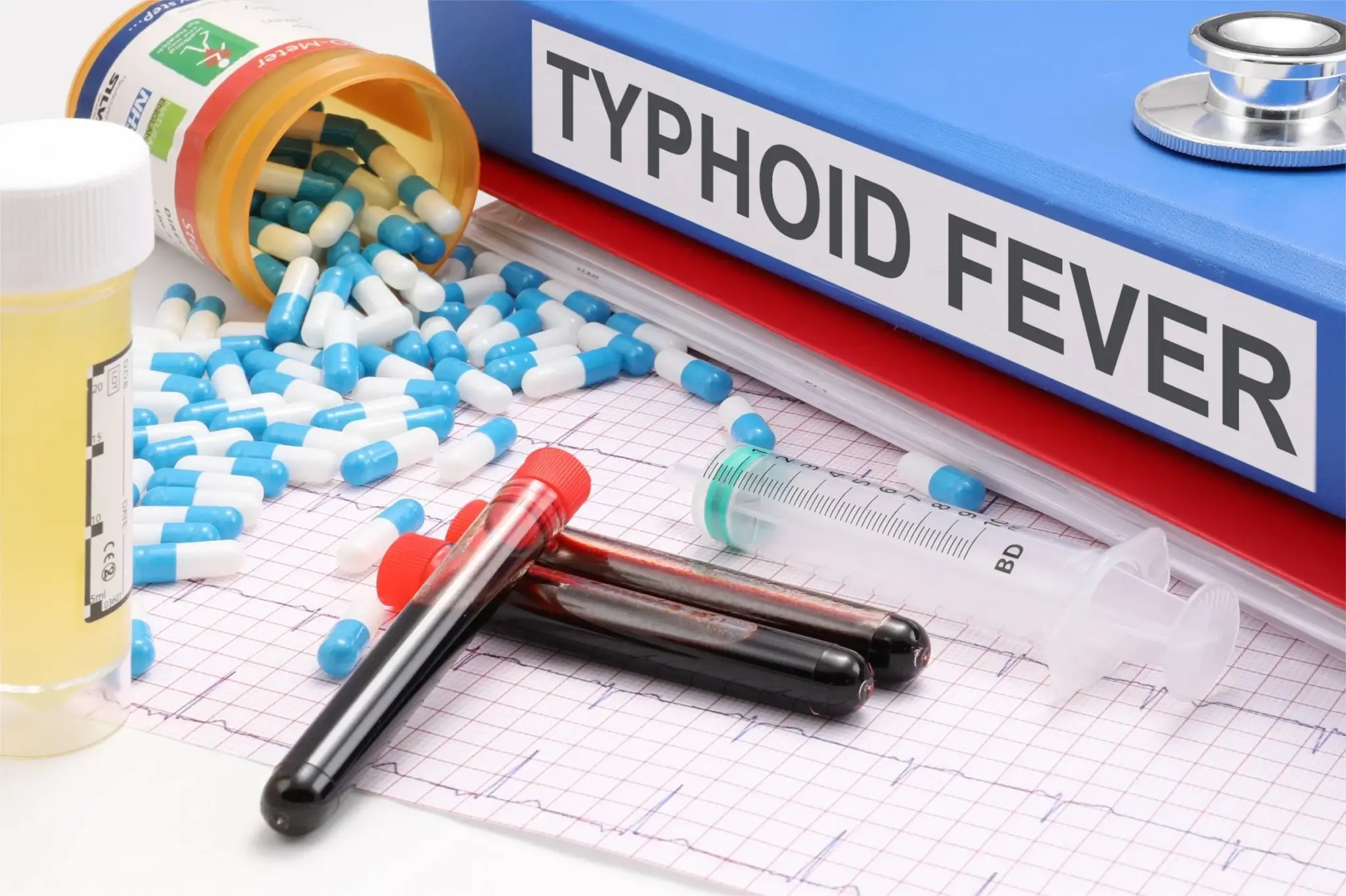 What is the Widal Test?