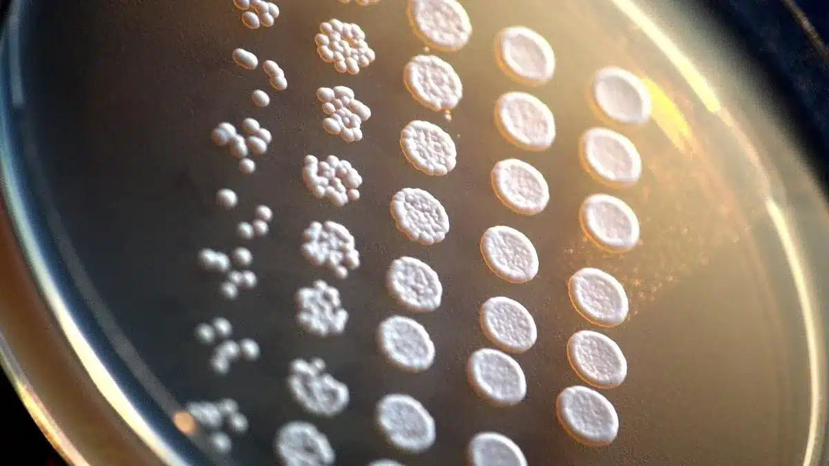 RNA Exosomopathies