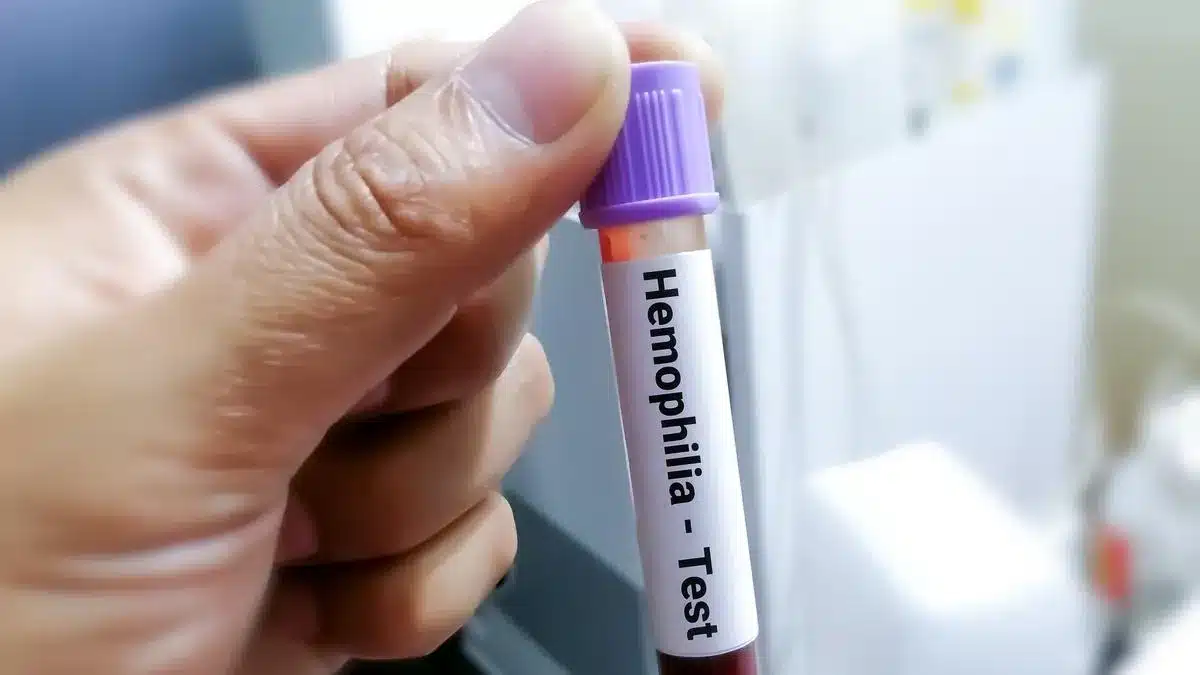 Gene Therapy Success in India