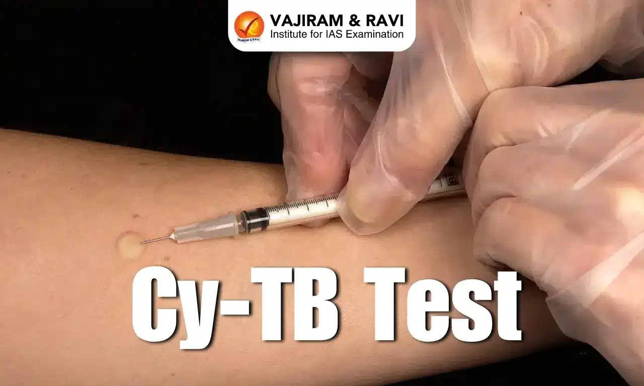 Cy-TB Test