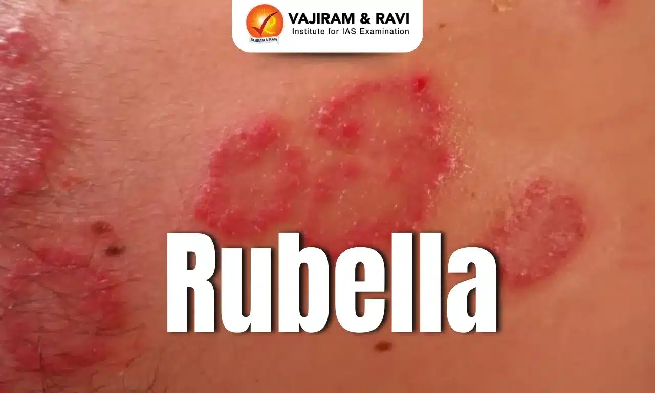 Rubella
