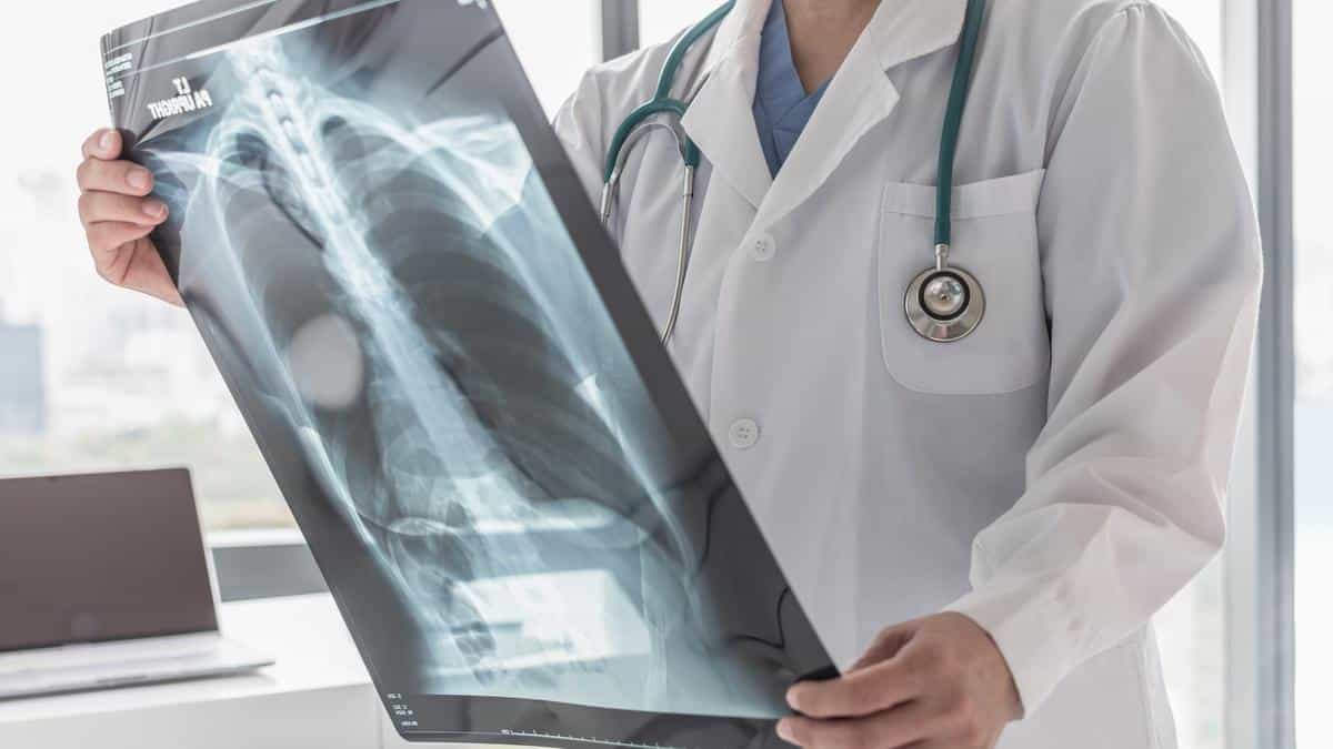 India’s Progress in Tackling Tuberculosis - Explained