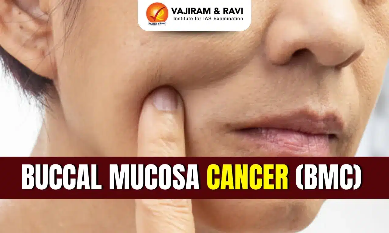 Buccal Mucosa Cancer (BMC)