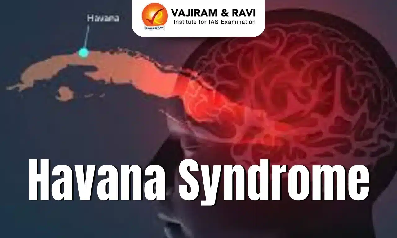 Havana Syndrome