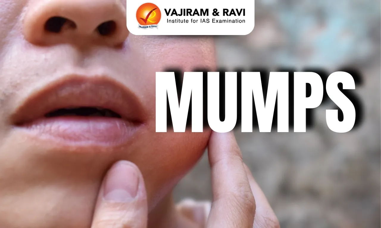 Mumps