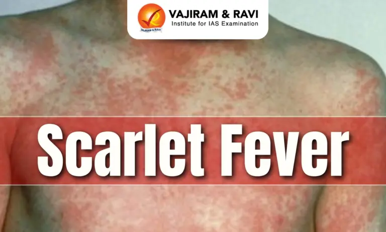 Scarlet Fever