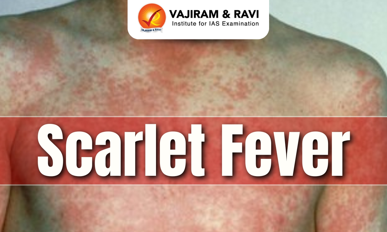 Scarlet Fever