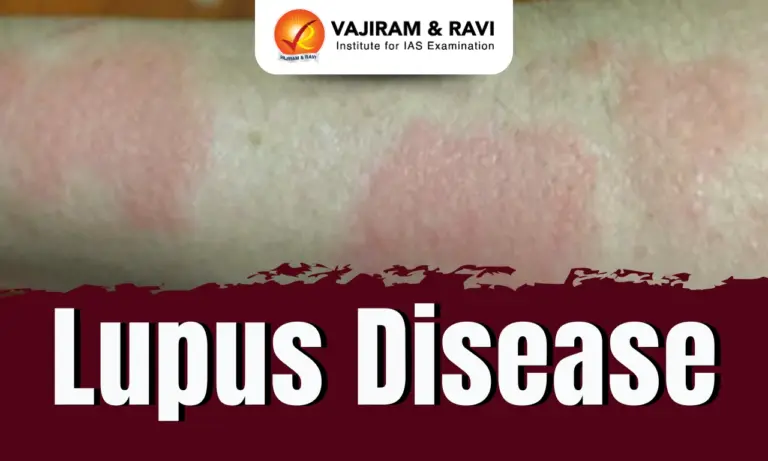 Lupus Disease
