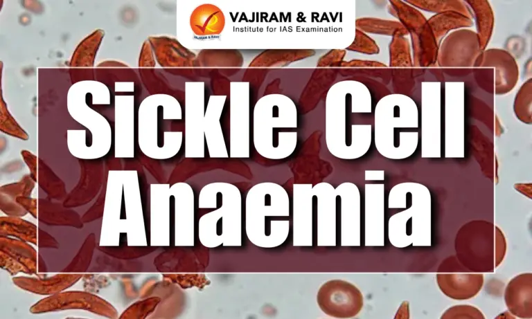 Sickle Cell Anaemia