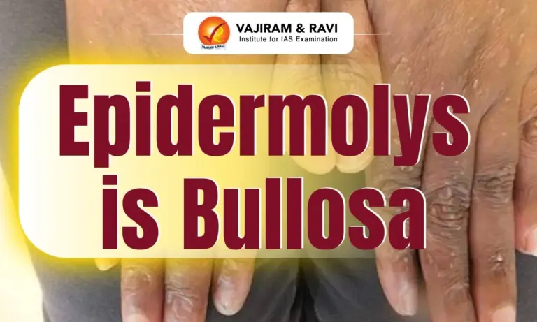 Epidermolysis Bullosa