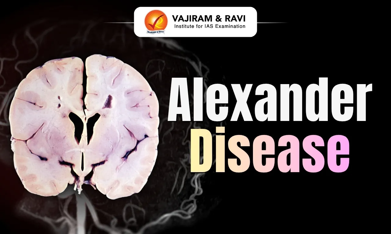 Alexander Disease