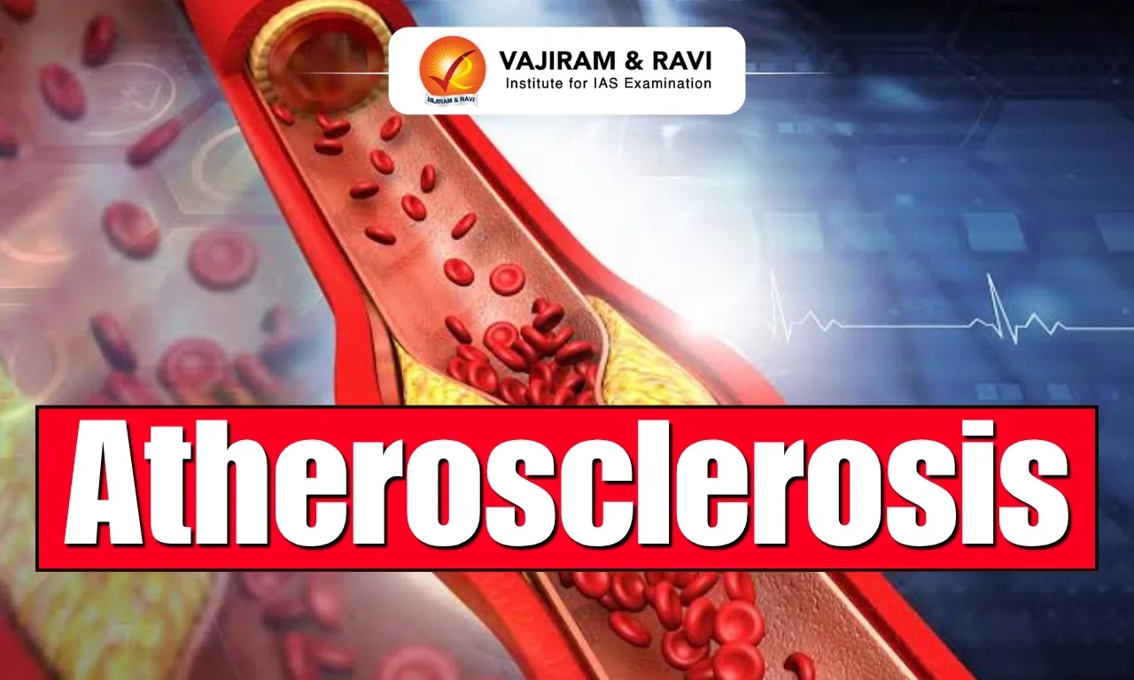 Atherosclerosis
