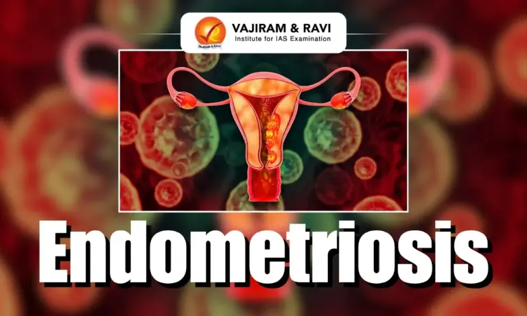 Endometriosis