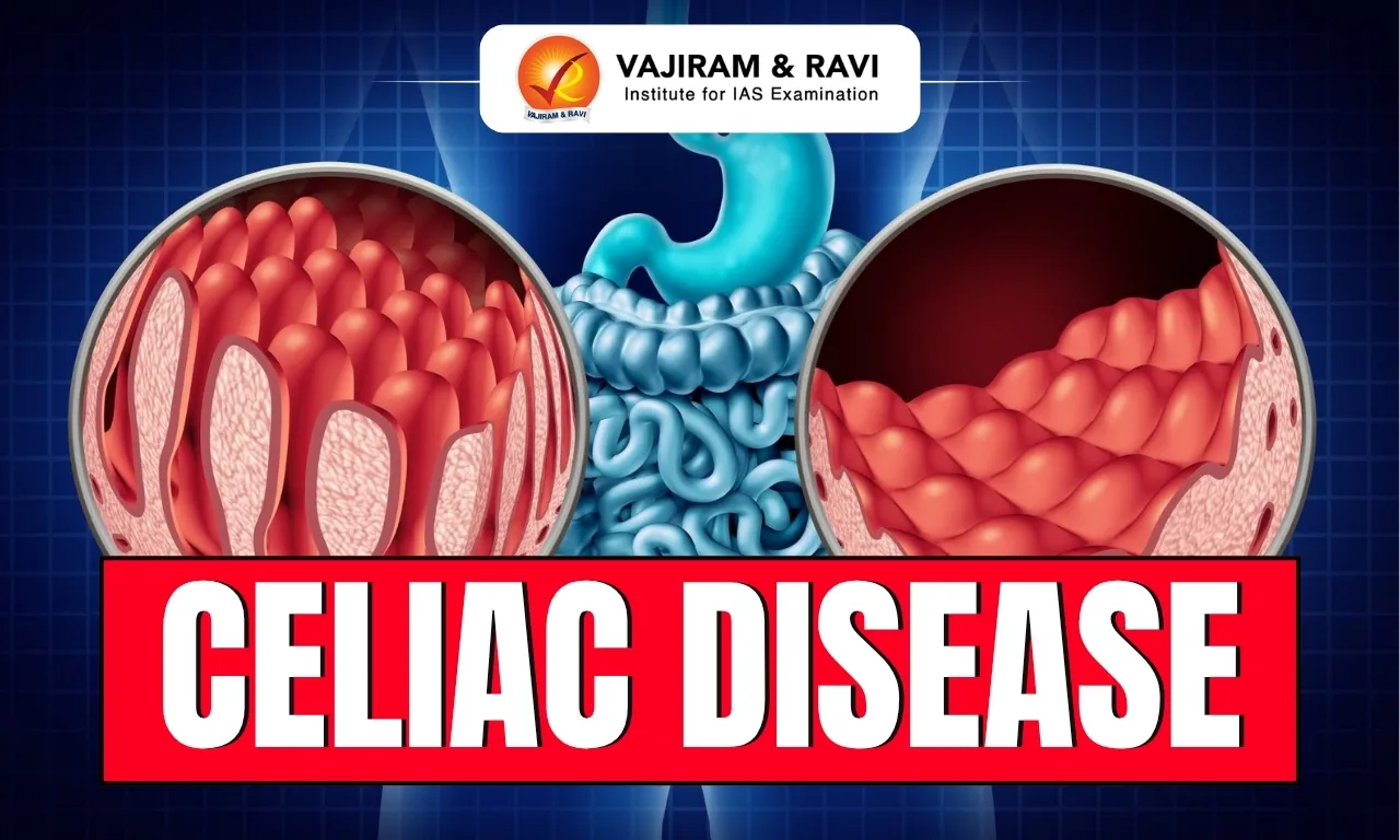 Celiac Disease