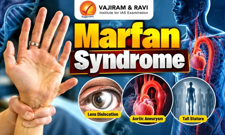 Marfan Syndrome