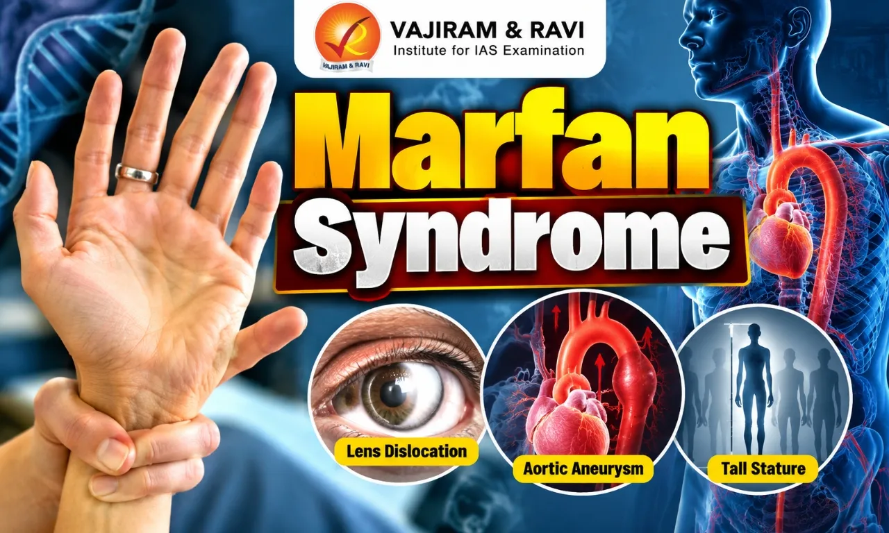 Marfan Syndrome