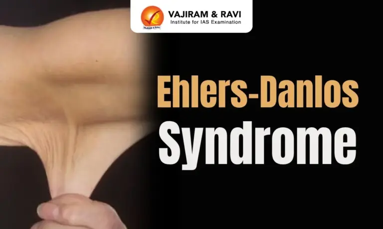 Ehlers-Danlos Syndrome