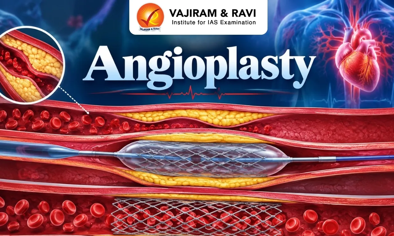 Angioplasty